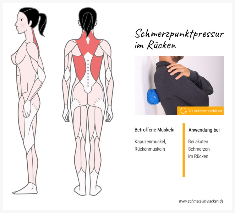 Mit der Schmerzpunkt-Pressur reizt du die Triggerpunkte in schmerzenden Muskeln und löst somit Schmerzen